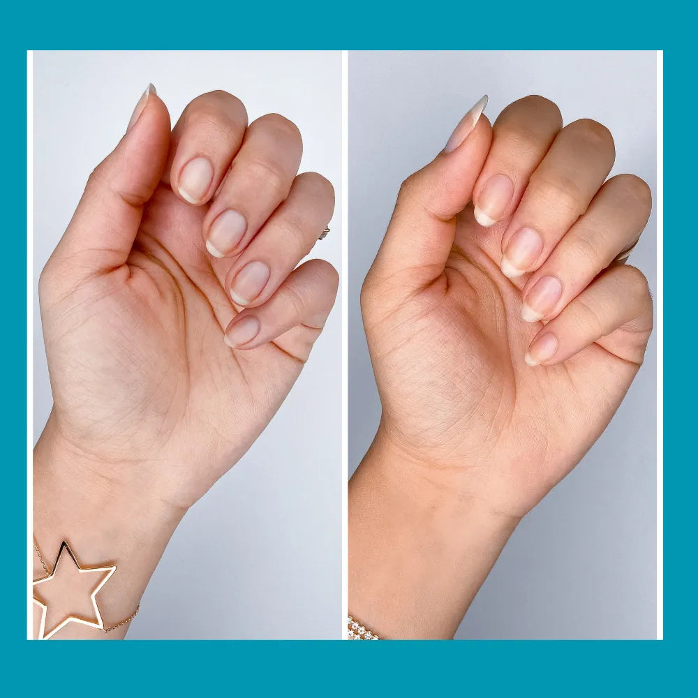 Before and after results of Shenora nail growth oil showing longer and stronger nails in 14 days